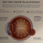 Why early glaucoma screenings matter: My family’s story